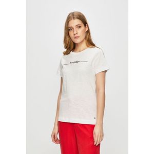 Tommy Hilfiger - Top kép