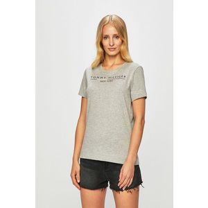 Tommy Hilfiger - Top kép
