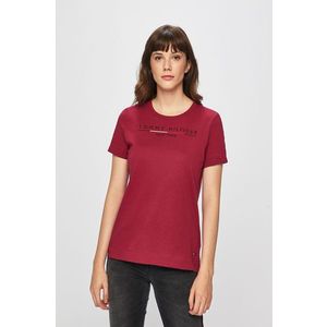 Tommy Hilfiger - Top kép