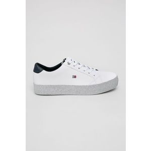 Tommy Hilfiger - Cipő kép